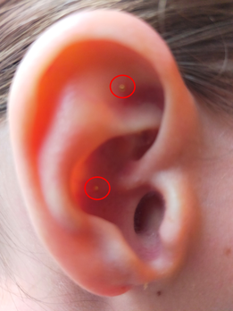 réflexologie auriculaire à Tours - Nathalie Repinçay